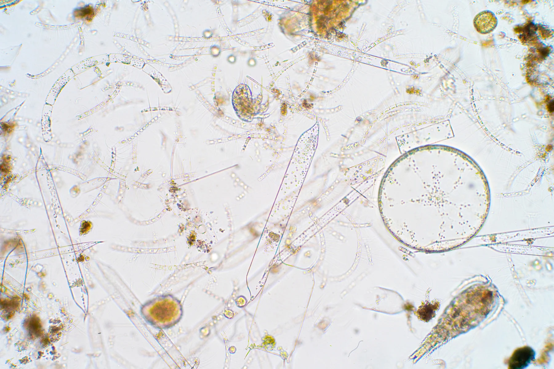 Microscopic image of marine plankton. (Choksawatdikorn/ Science Photo Library/ Getty Images)