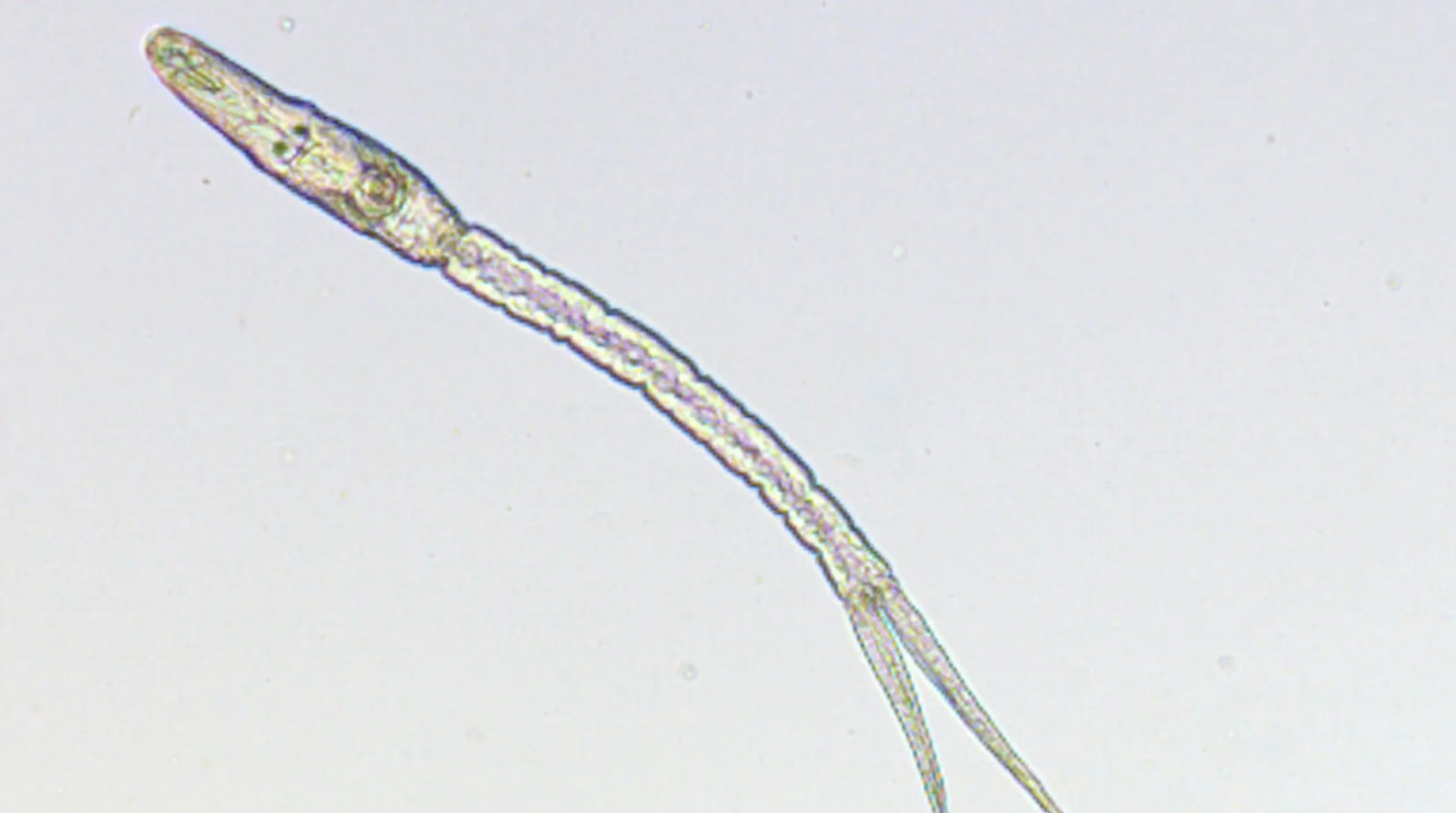 Provided/Patrick Hanington: Microscopic view of the parasite that leads to swimmer's itch