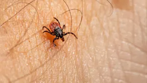 Why Canadians need to get ready for a U.S. tick invasion this year