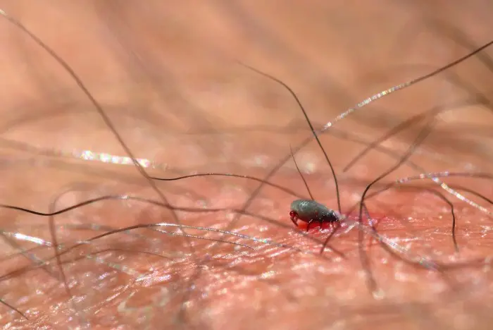 CONVERSATION :  une injection saisonnière pourrait prévenir la maladie de Lyme