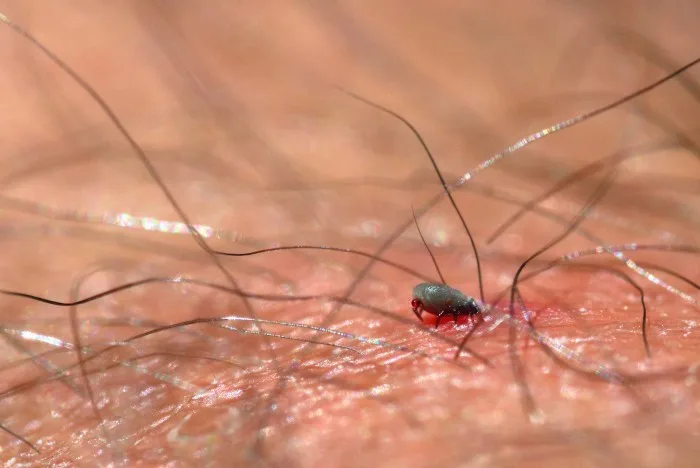 CONVERSATION :  une injection saisonnière pourrait prévenir la maladie de Lyme