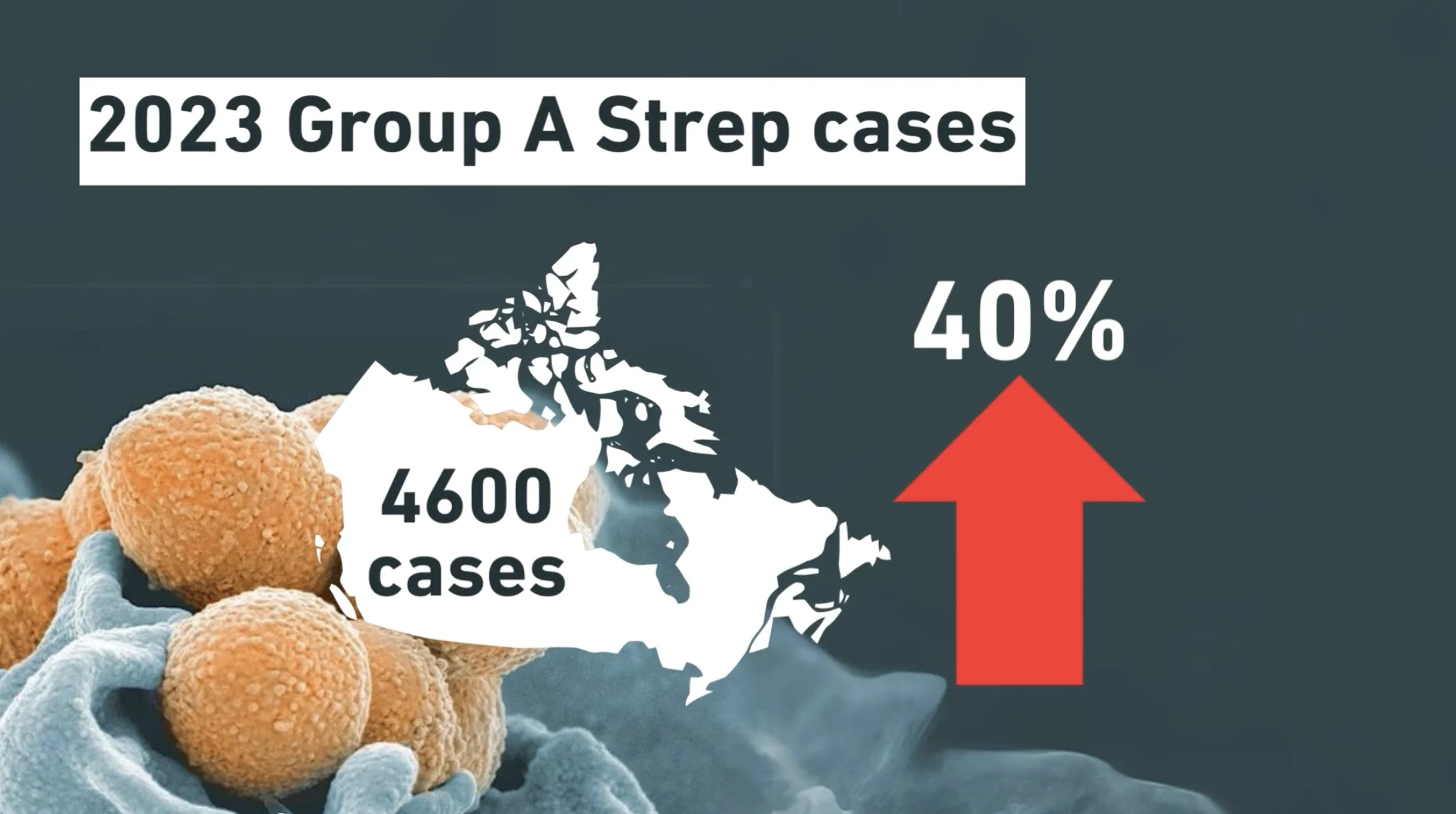 Strep A: Cases of Streptococcus pyogenes, or Strep A, rose per cent in 2023 over the previous yearly high in 2019 (Public Health Canada)