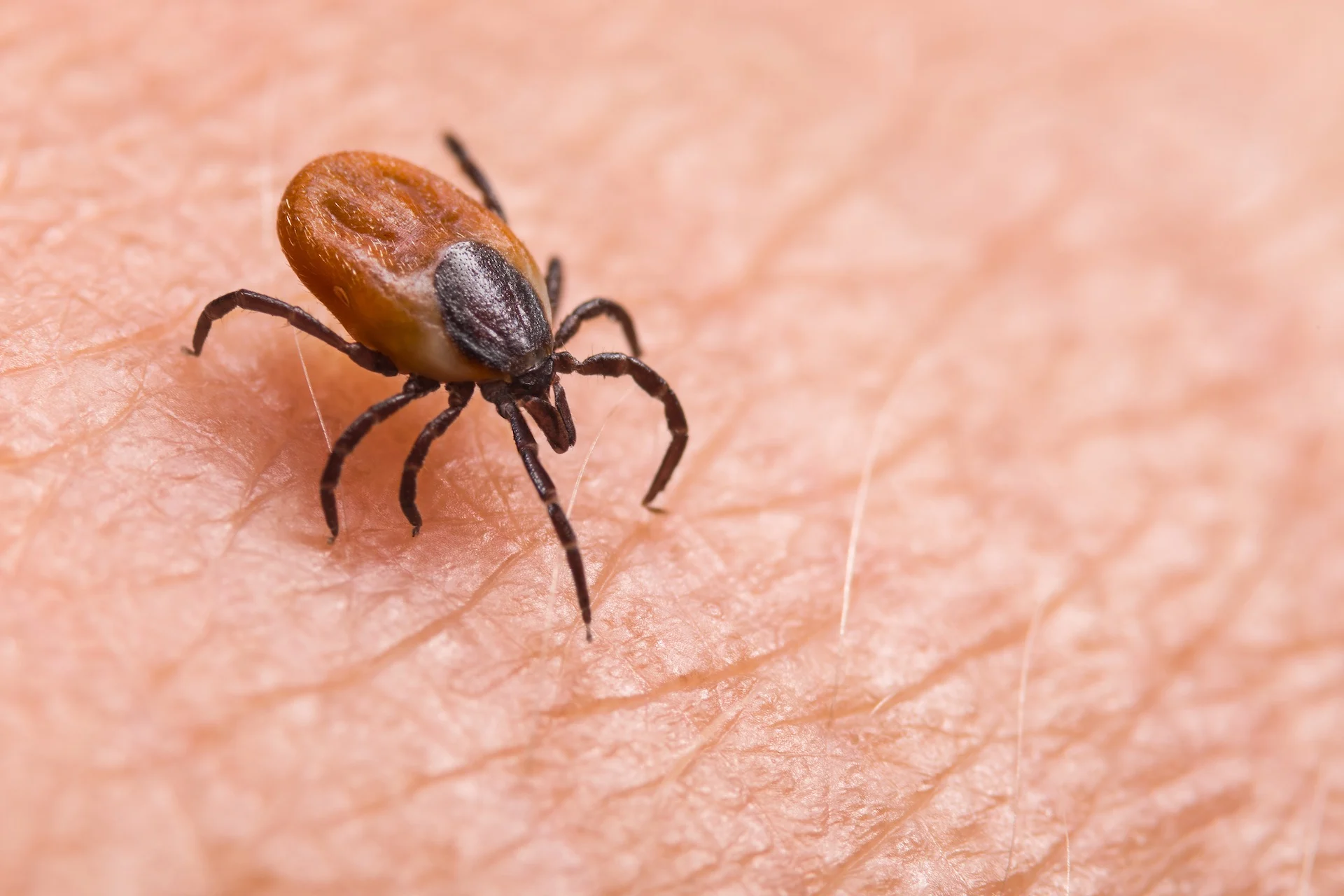 Bitten by a tick? Here's the trick to handling it in a safe manner
