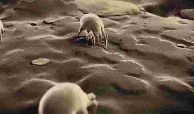 Dust mites, allergies. Courtesy: The Weather Network