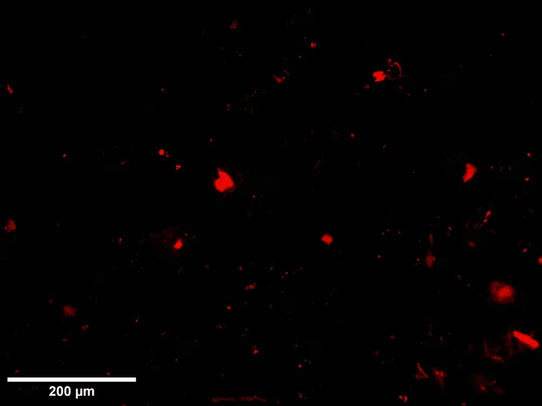 CBC: A sample of the microplastics collected by Dalhousie students durring Hurricane Larry, as seen through a microscope. (Submitted by Anna Ryan)