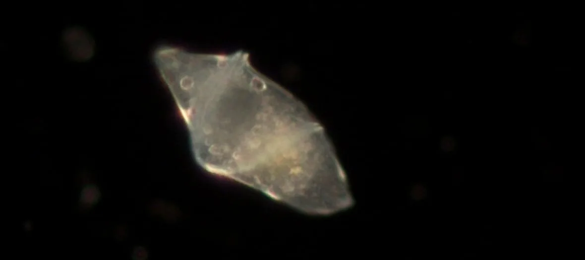 Dinoflagellate phytoplankton are understood to be less valuable food than diatoms for the creatures that consume them. (Ruby Hu/Dalhousie University)