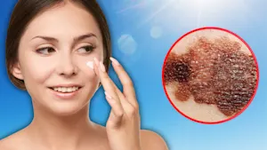 If a contoured face is your goal this summer, use makeup, not the sun. Here's why