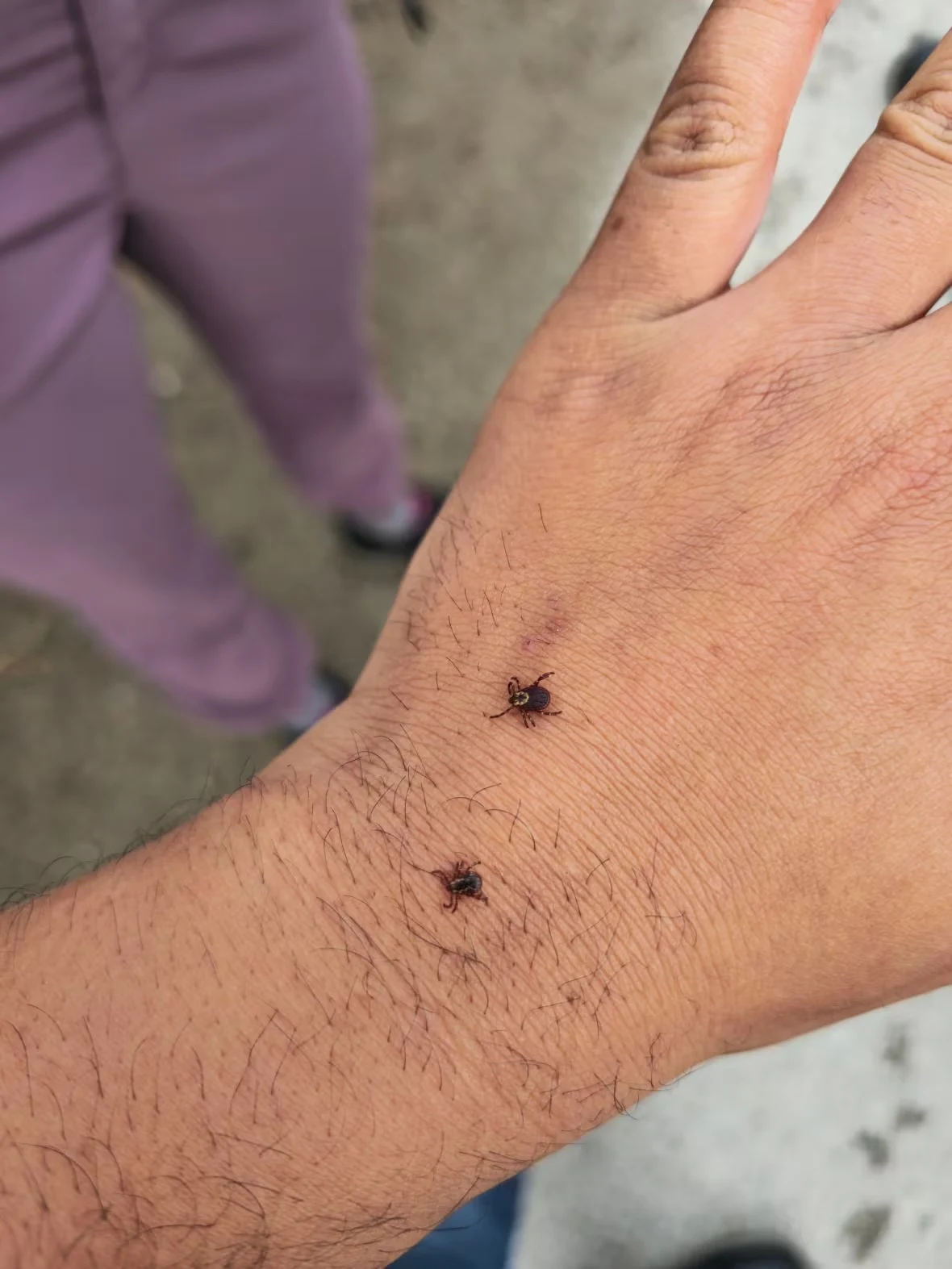 dog-ticks-on-hand/Bipin Dhinsa via CBC
