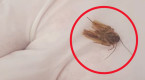 Doctor removes cockroach stuck inside man's ear for three days