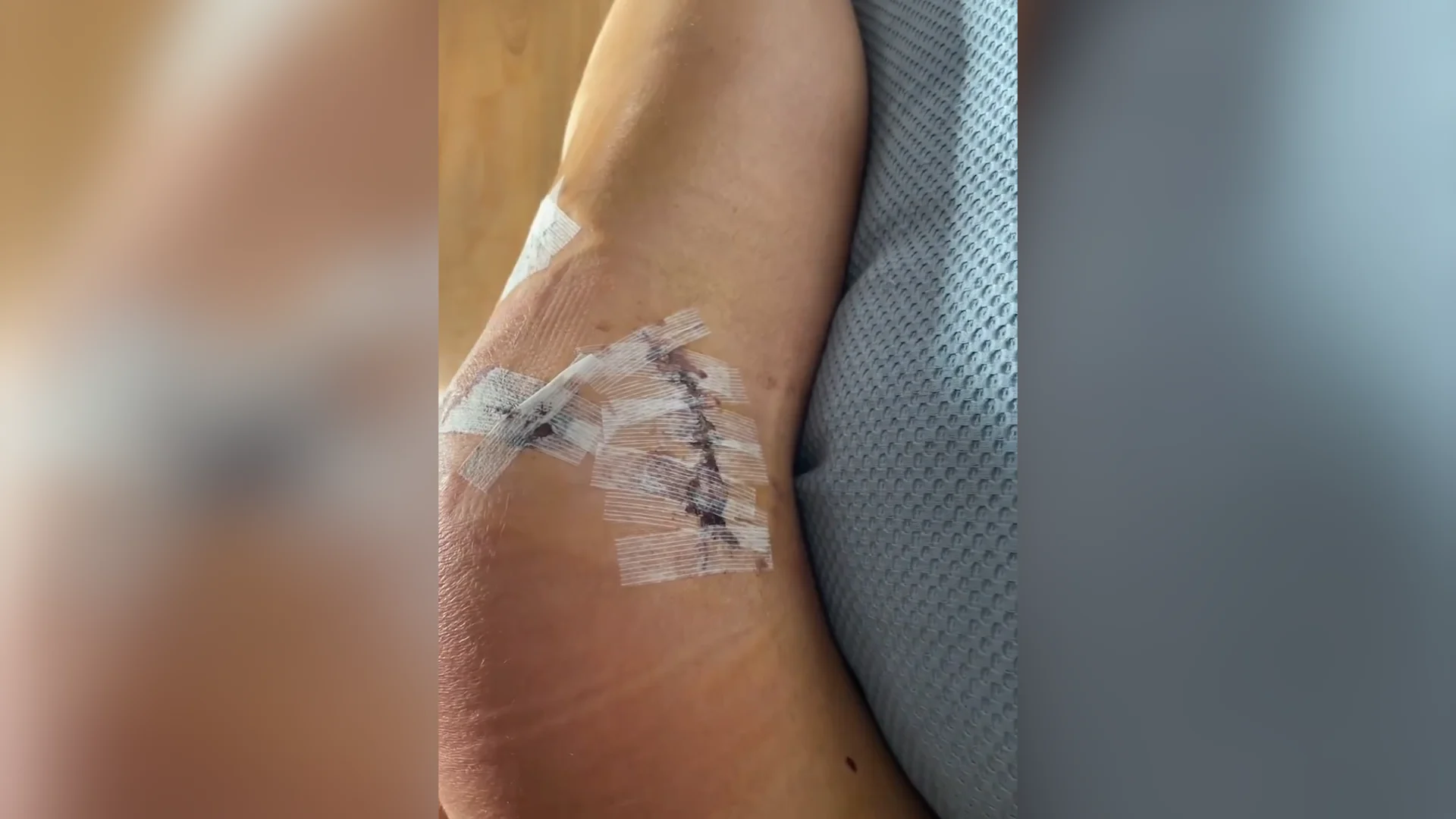 (Kiki Alexander) Knee injury