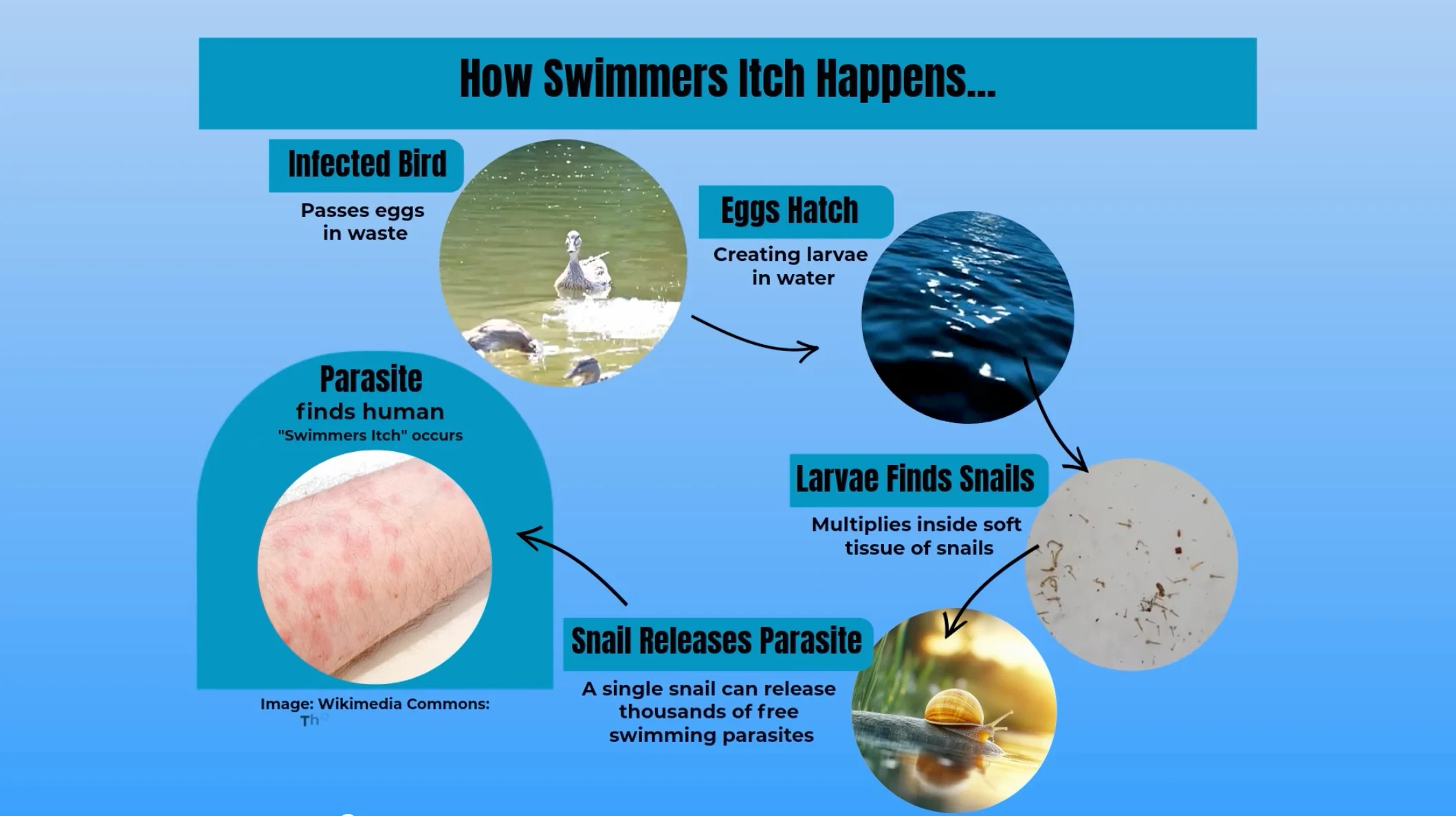 TWN: How you develop swimmer's itch