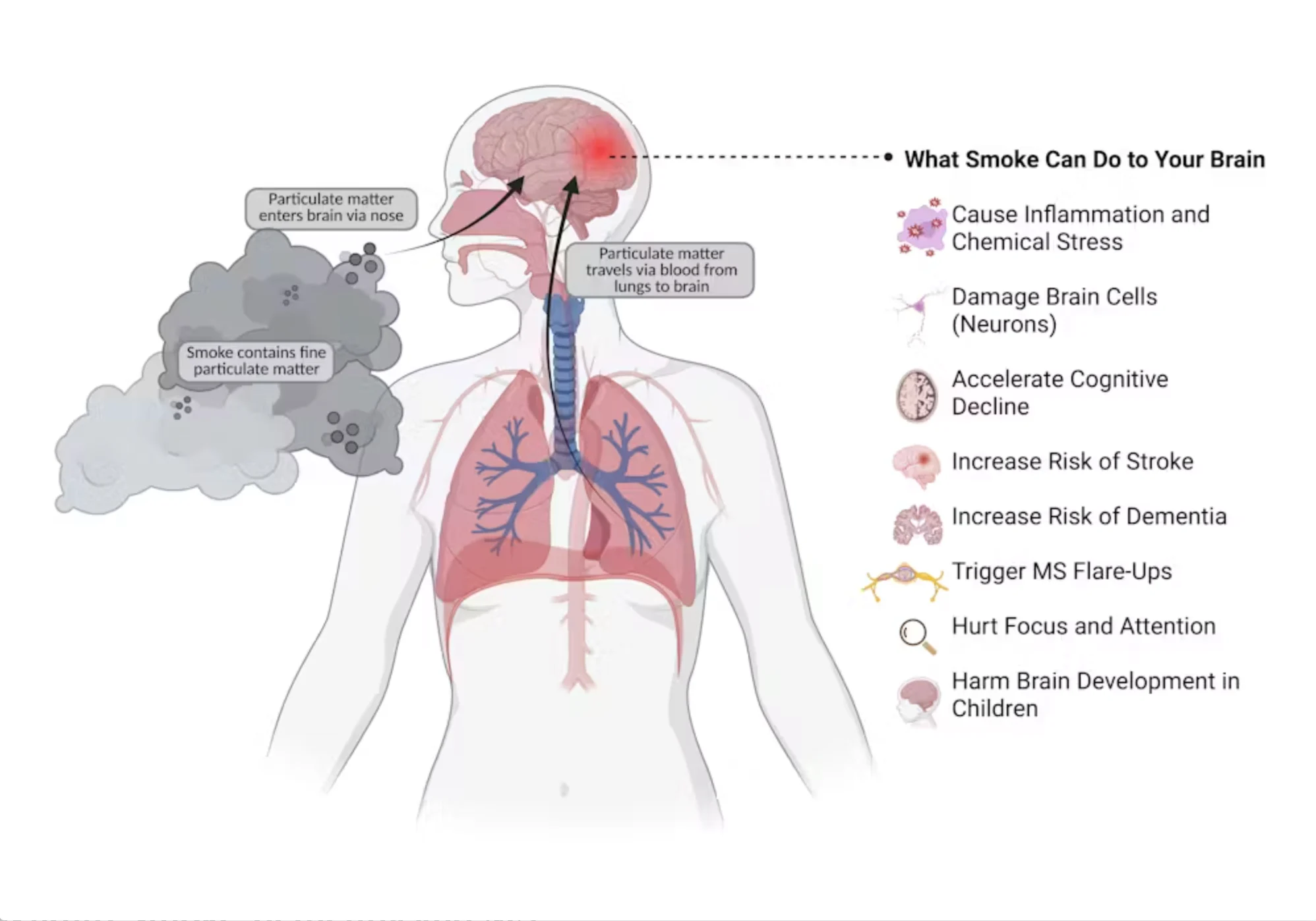 Do not reuse - from The Conversation: Fine particulate matter in wildfire smoke can reach the brain via the lungs or nose, causing inflammation, neuronal damage, and raising the risk of stroke, dementia, cognitive decline, and MS flare-ups. (Muskaan Muse Laroyia)
