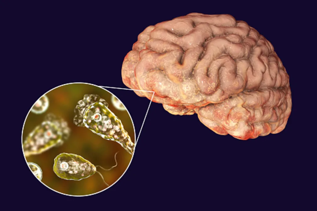 Getty: Brain-eating amoeba