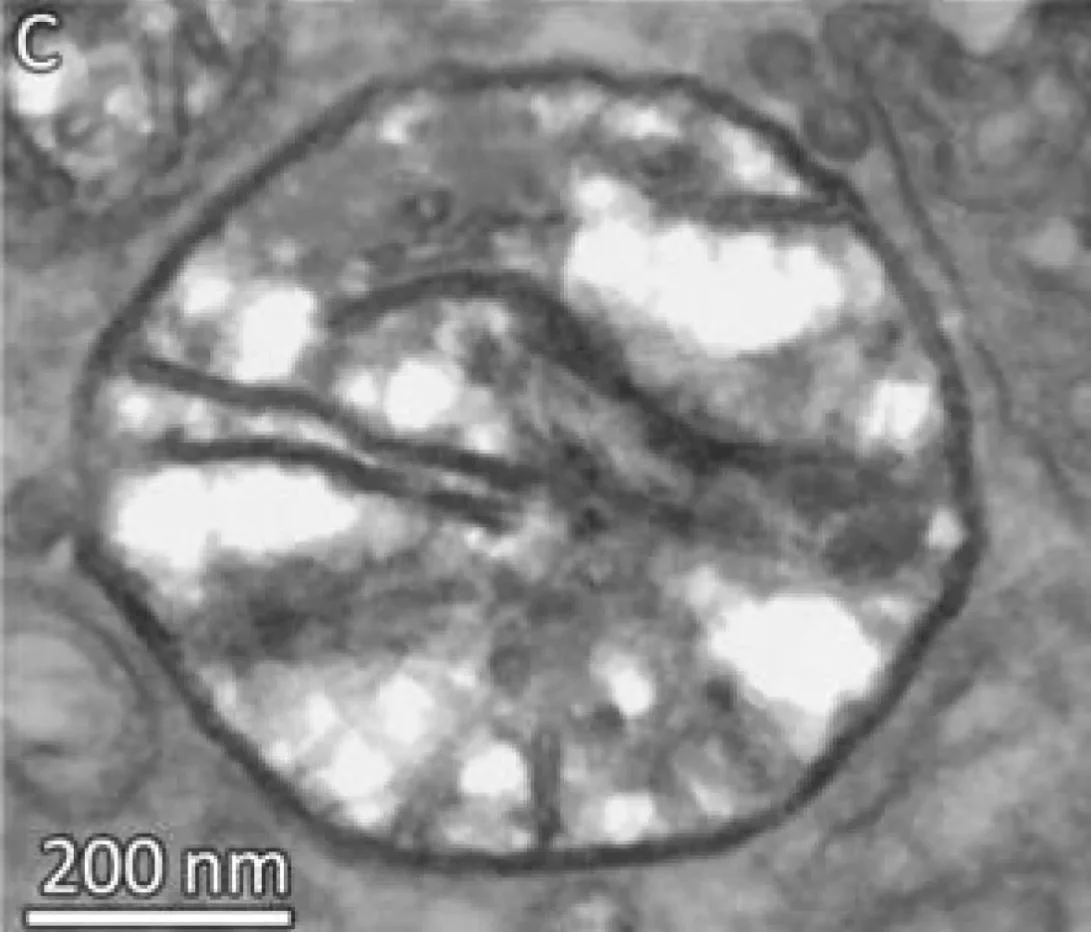 Mitochondria anoxic parasite cbc