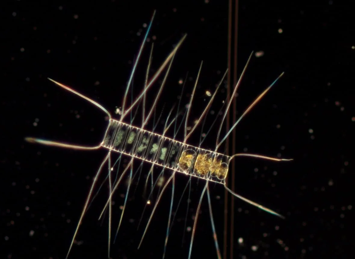 Researchers expected to find a smaller proportion of diatom biomass in the phytoplankton population compared with dinoflagellates, but that wasn't reflected in the data. (Ruby Hu/Dalhousie University)
