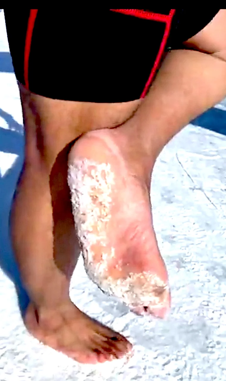 Karim El Hayani feet